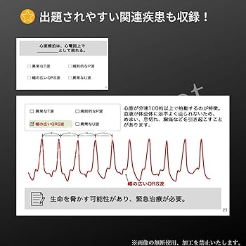 Amazon.co.jp: 心電図暗記カード 看護師 理学療法士 作業療法士